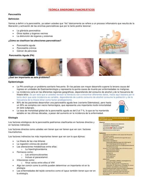 Pancreatitis 