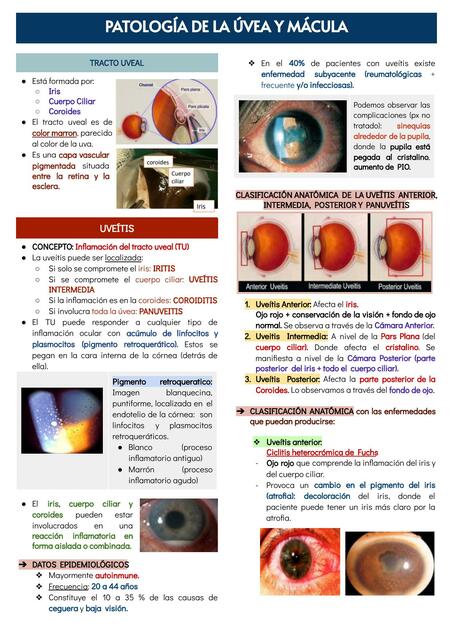 Patología de la Úvea y Mácula 