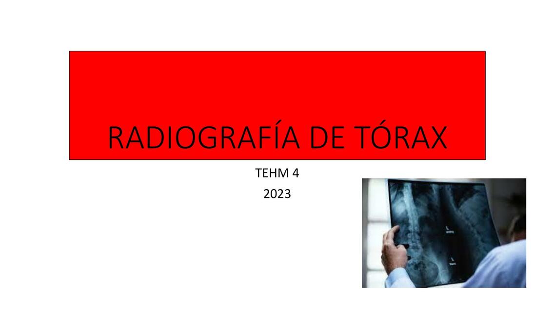 Radiografía tórax