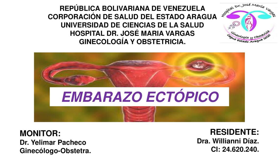 Embarazo Ectópico 