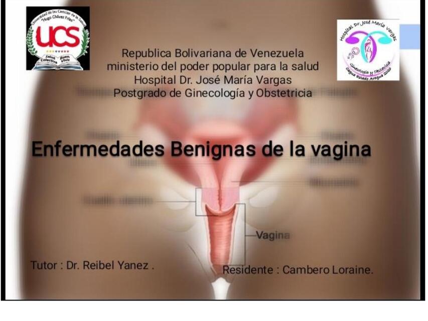 Enfermedades benignas de la vajina 