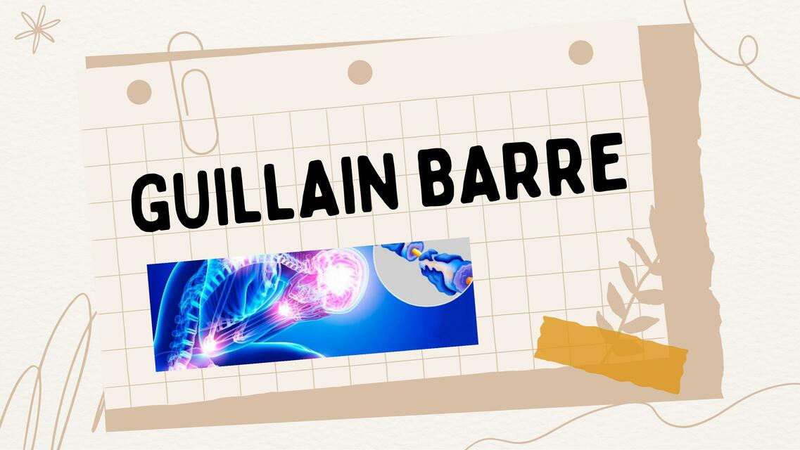 Guillain barre 