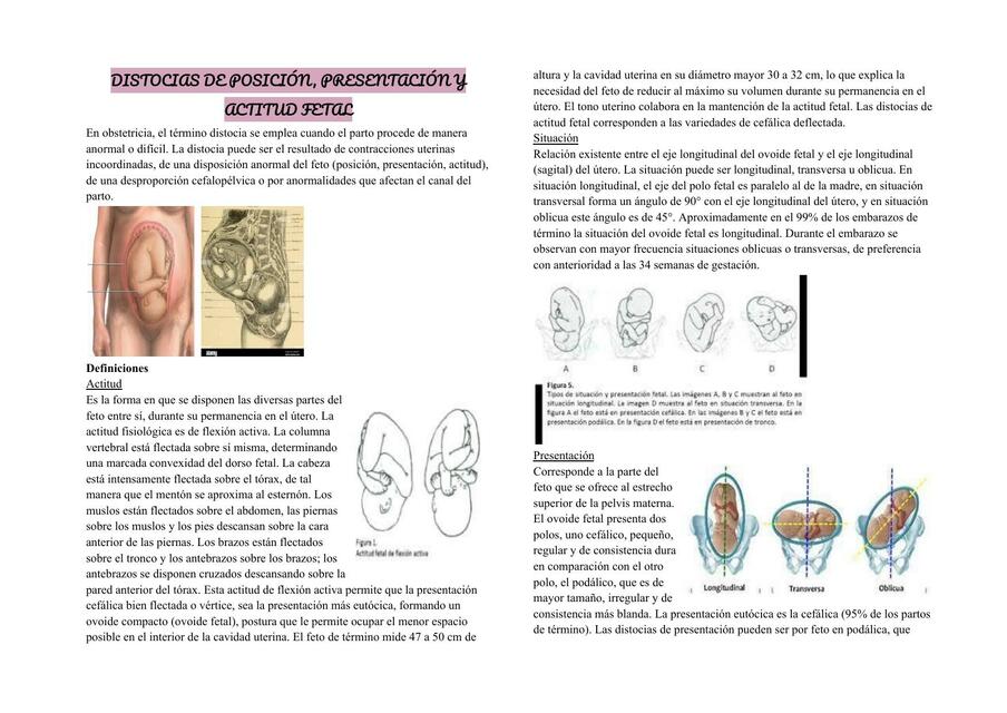 Distocias de Posición, Presentación y Actitud Fetal