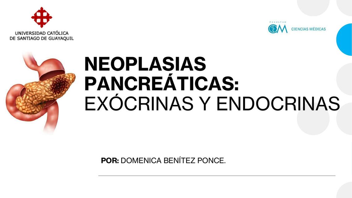 Neoplasias pancreáticas: exócrinas y endocrinas 