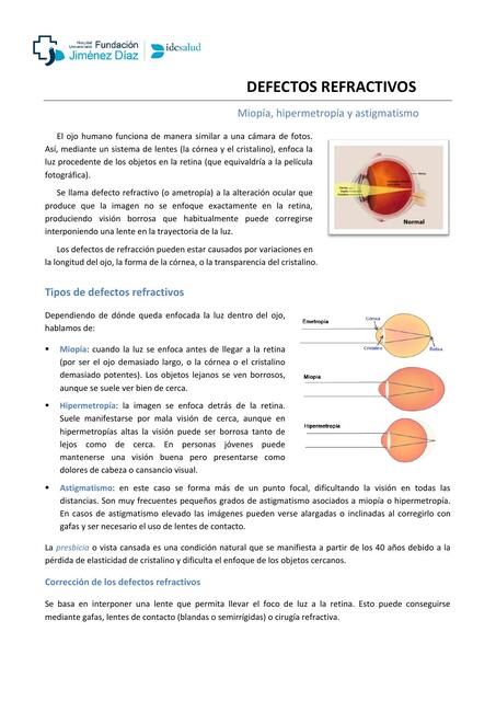 Defectos refractivos 