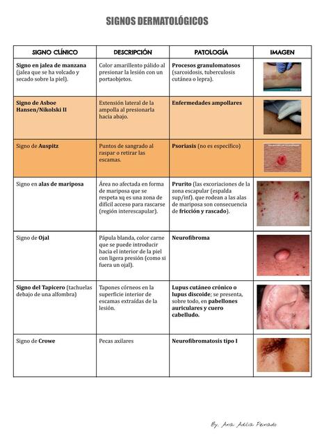 Signos dermatológicos Fitzpatrik 1