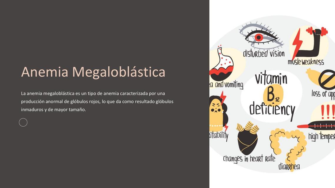 Anemia Megaloblástica    