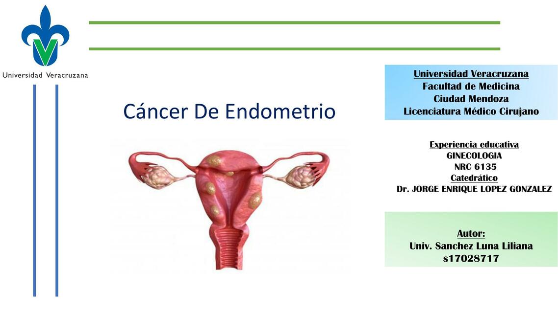 Cáncer de Endometrio 