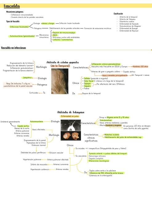 Vasculitis