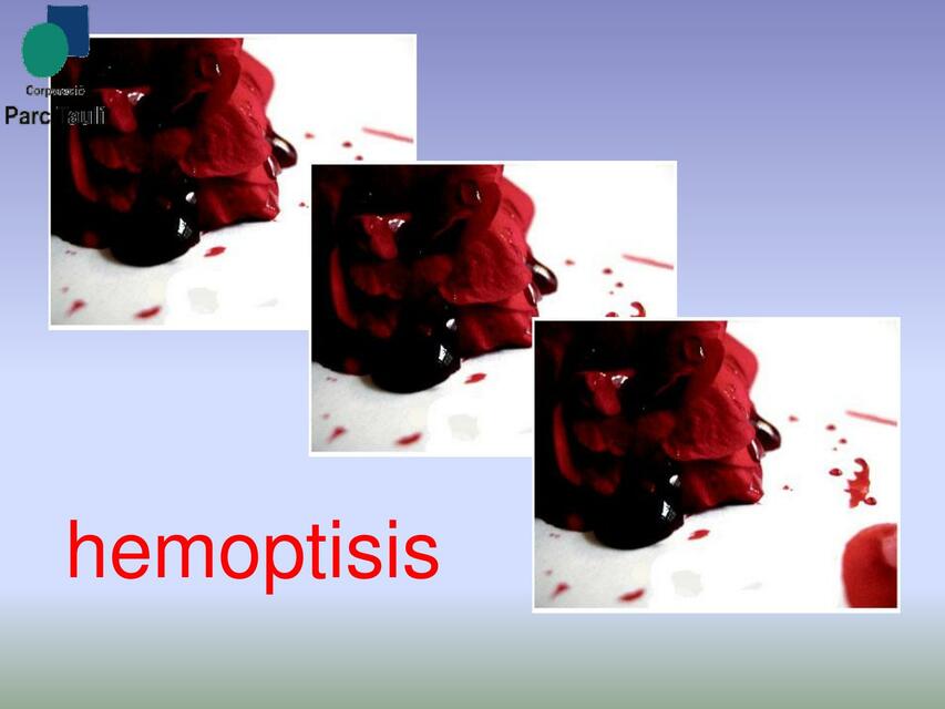 Hemoptisis