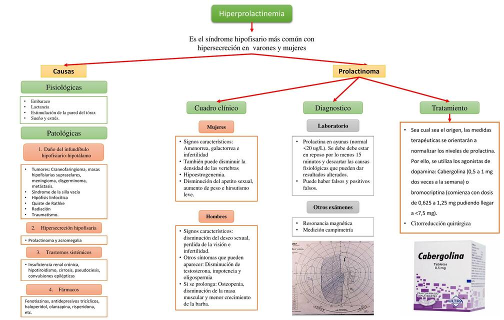 Hiperprolactinemia