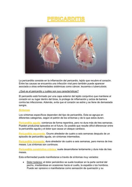 Pericarditis