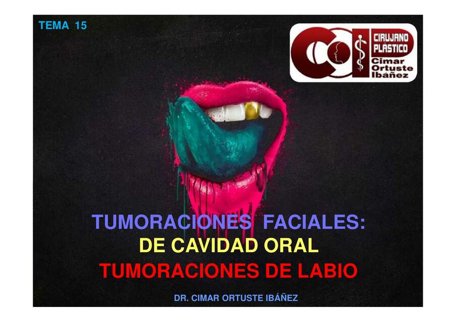 Tumoraciones faciales de cavidad oral 