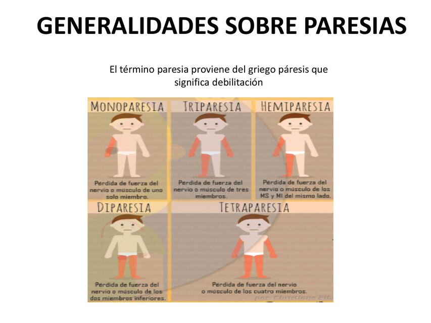 Generalidades sobre paresias