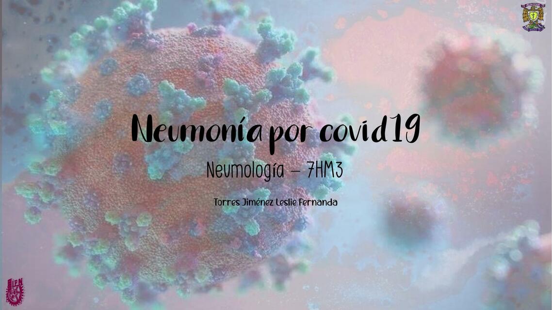 Neumonia por Covid 19