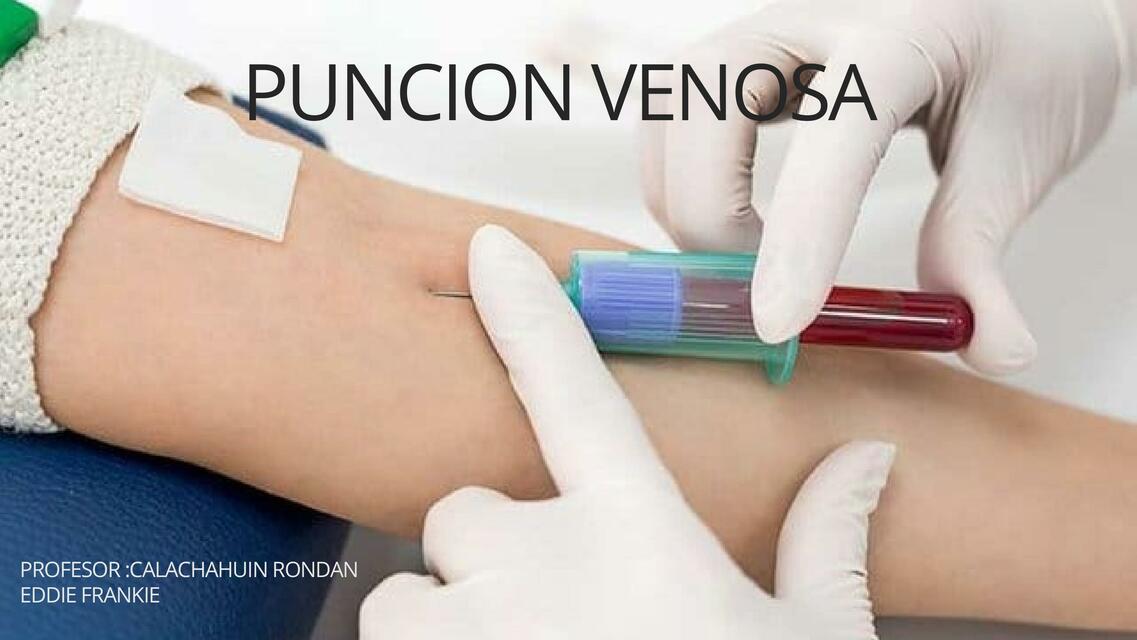 Punción Venosa 