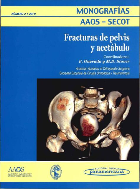 Fracturas de la pelvis y acetábulo 