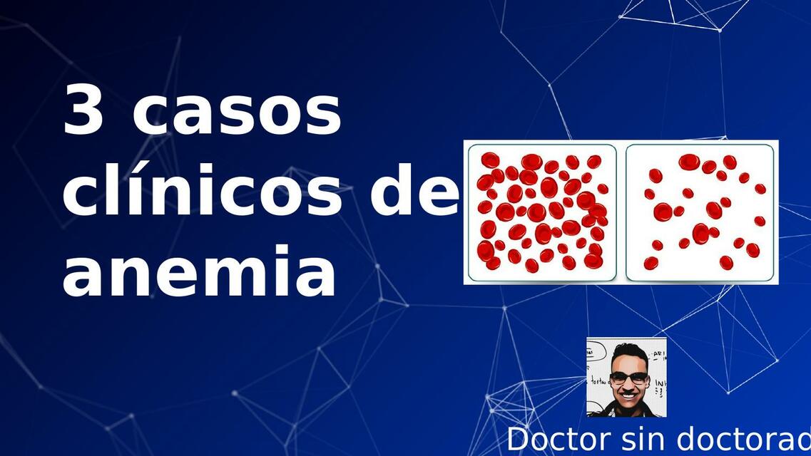 Casos clinicos de anemia