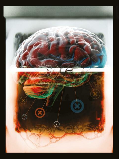 Filtraciones en la Barrera Cerebral 