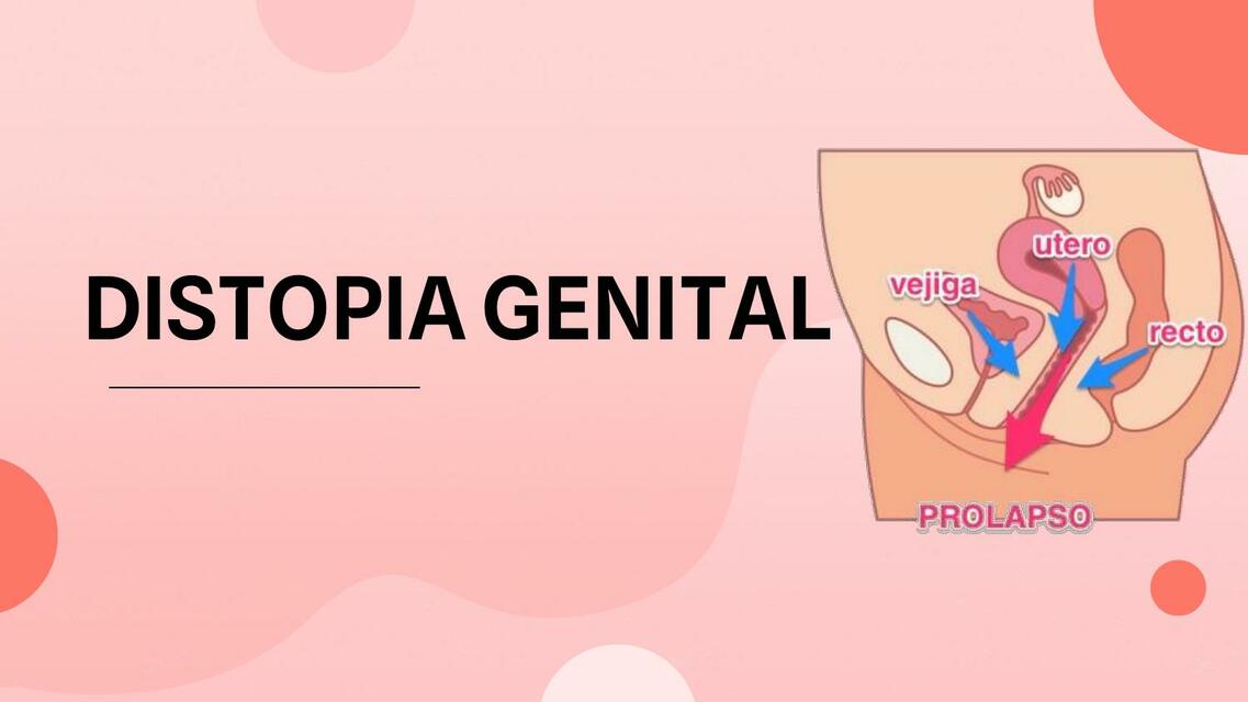 Distopia Genital