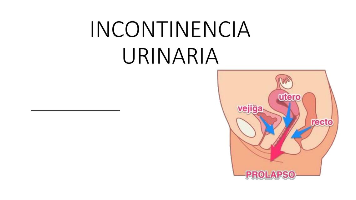 Incontinencia urinaria 