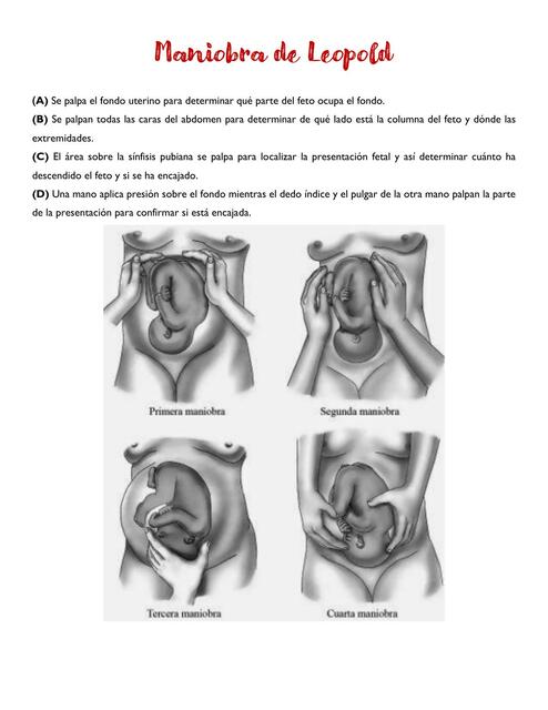 Maniobra de Leopold