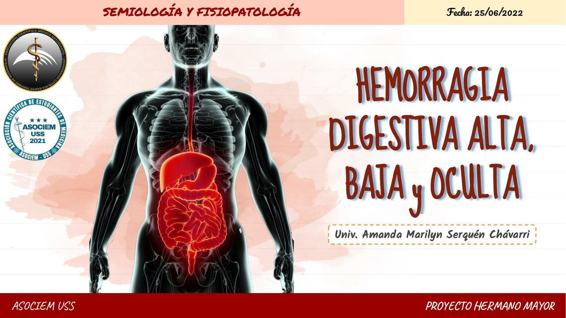 Hemorragia Digestiva Alta, Baja y Oculta 