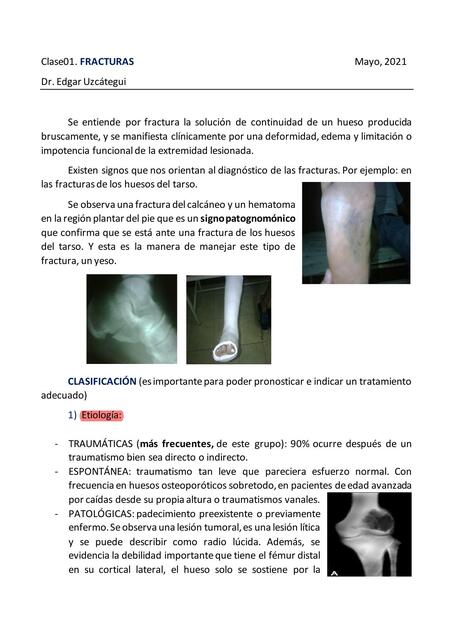 Clase 01 Fracturas