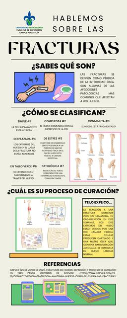 Infografía de fracturas