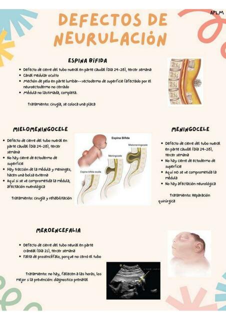 Defectos de Neurulación