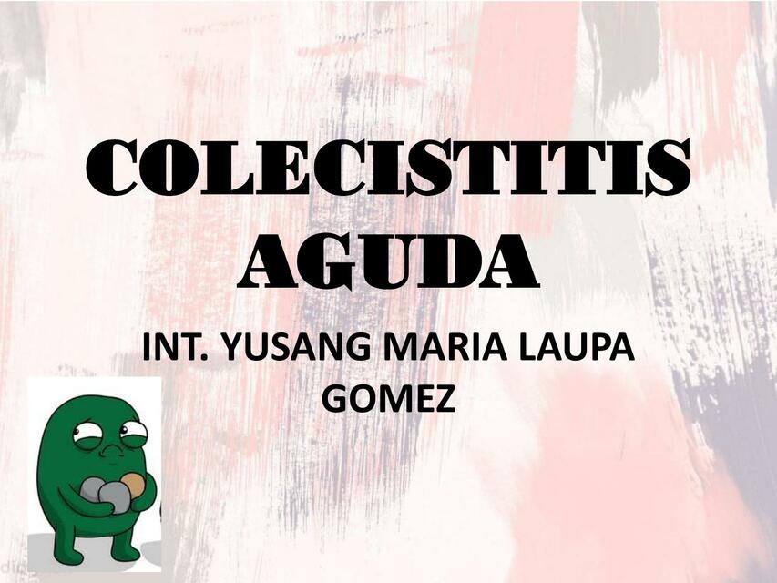 Colecistitis Aguda 