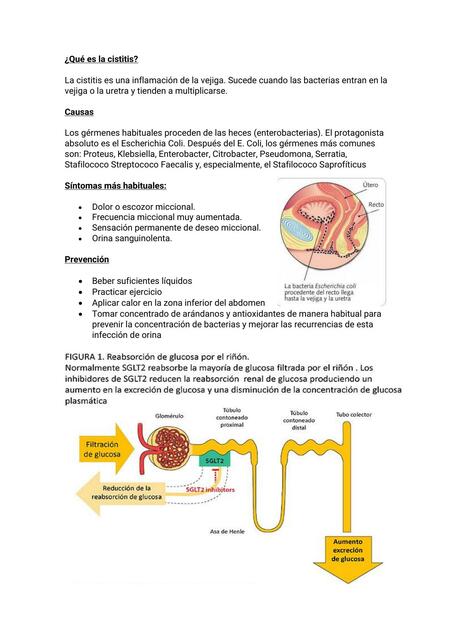 Qué es la cistitis