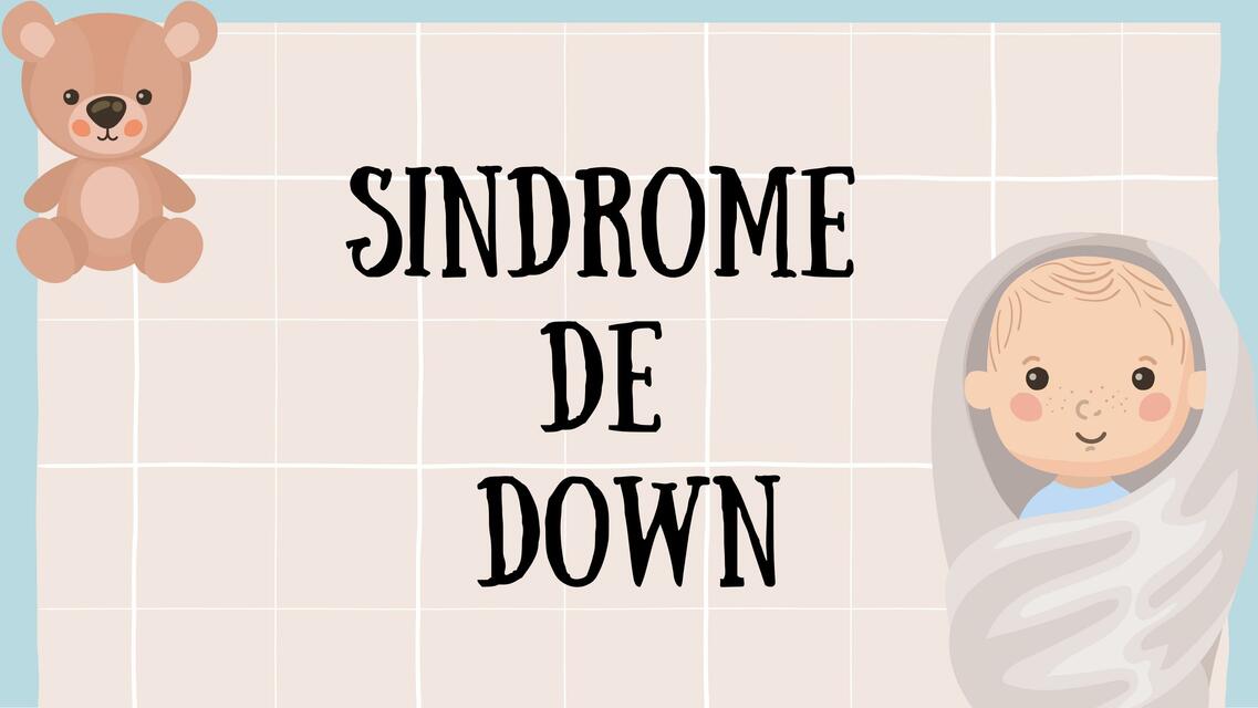 Síndrome de Down 