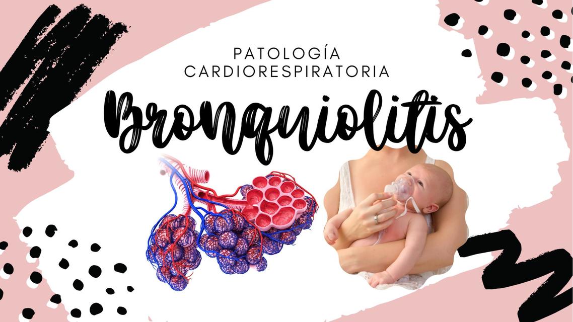 Presentación bronquiolitis