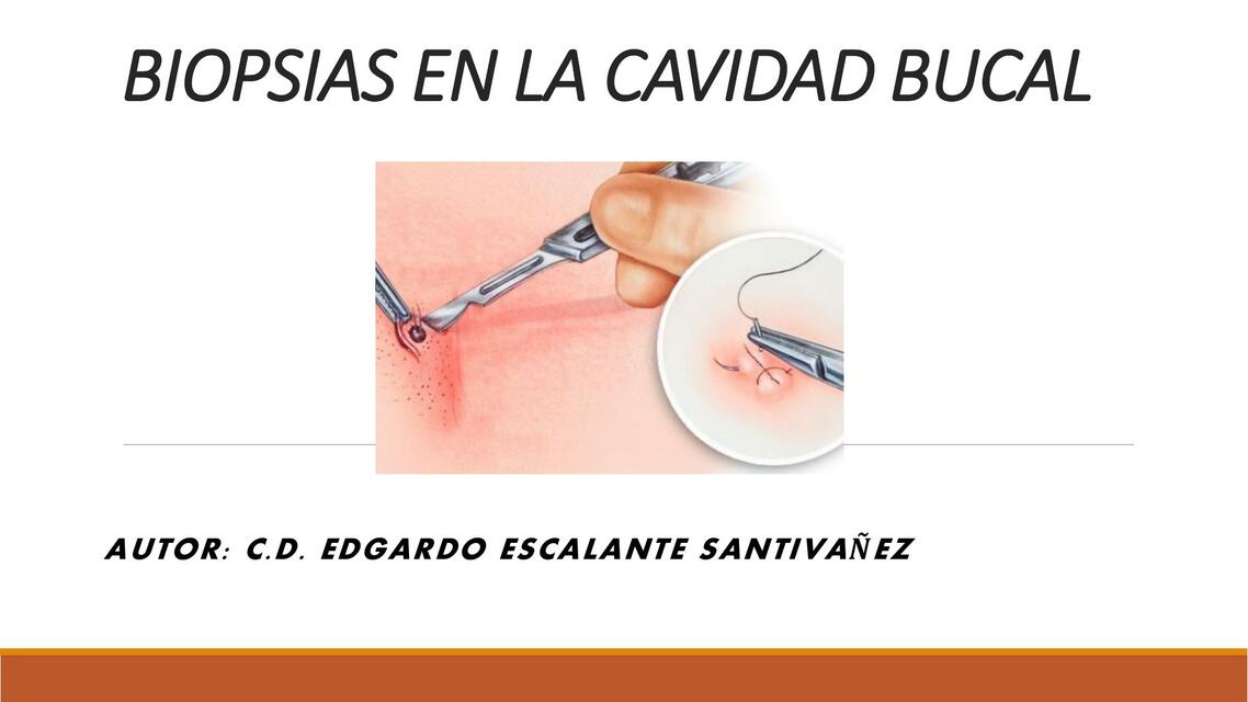 Biopsias en la Cavidad Bucal 