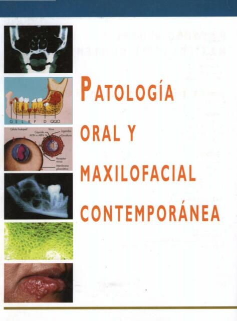 Patología oral y maxilofacial