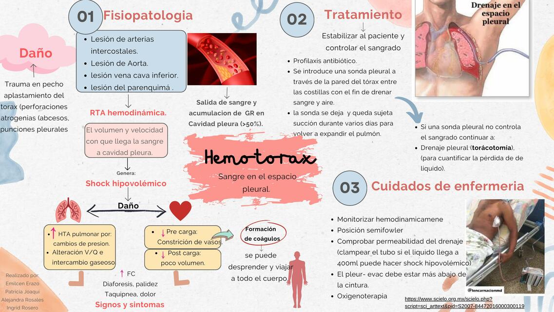 Hemotórax 