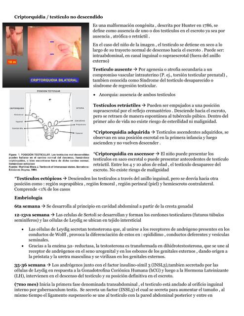 Criptorquidia testículo no descendido 