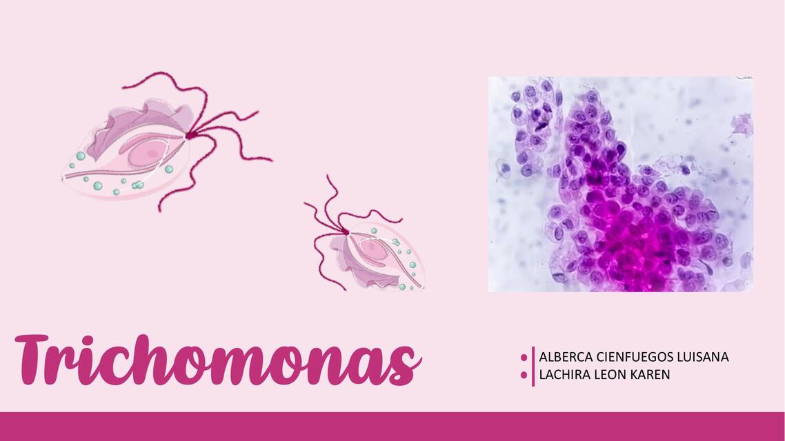 Trichomonas ( t. vaginalis, t. tenax, t. hominis