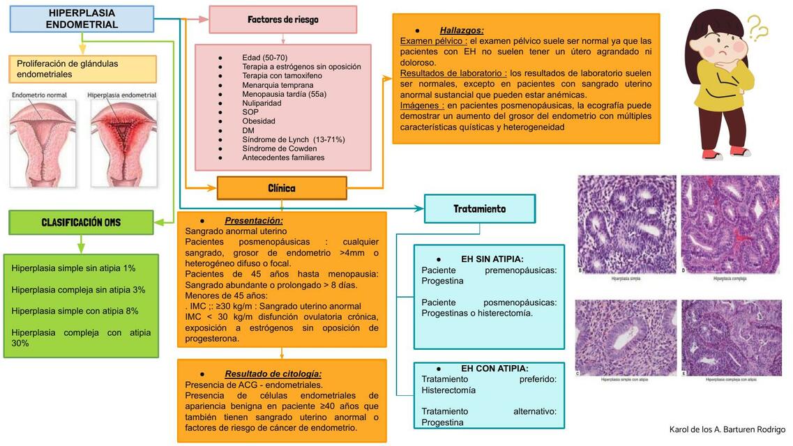 Hiperplasia Endometrial 