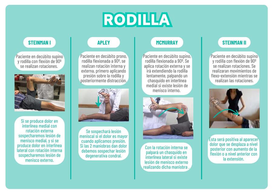 Rodilla 