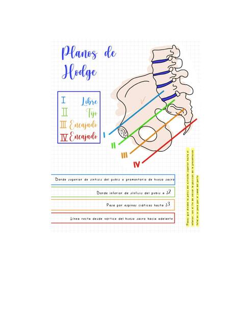 Planos de Hodge y planos de DeLee