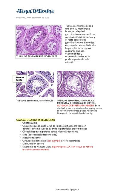 Atrofia testicular