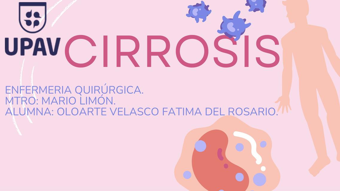 Cirrosis