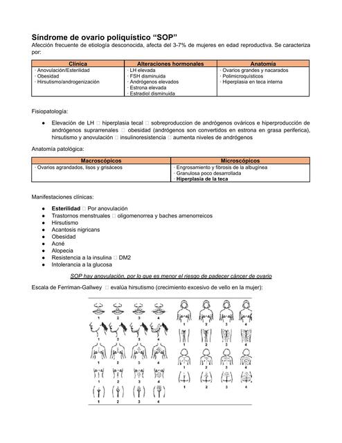 Síndrome de ovario poliquístico 