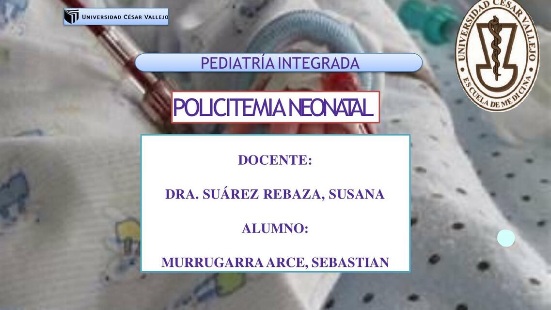 Policitemia neonatal