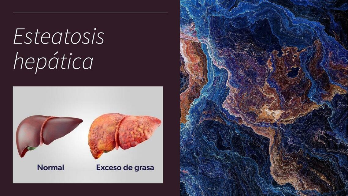 Esteatosis hepática