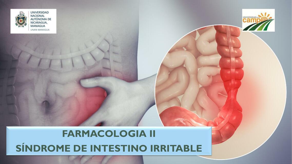 Síndrome de intestino irritable 