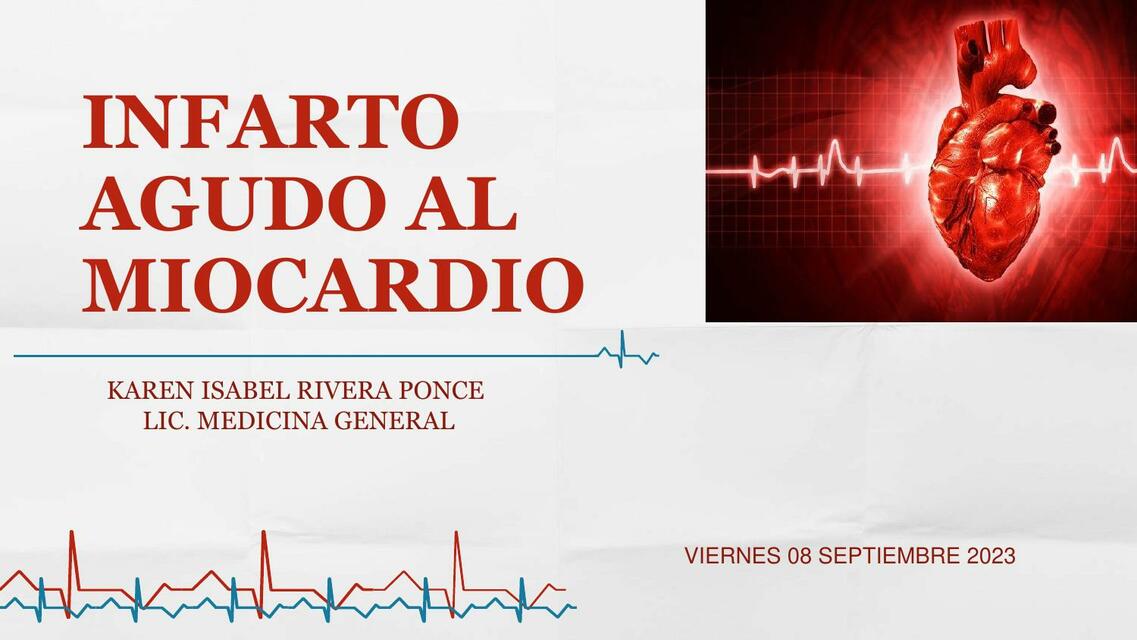 Infarto agudo miocardio