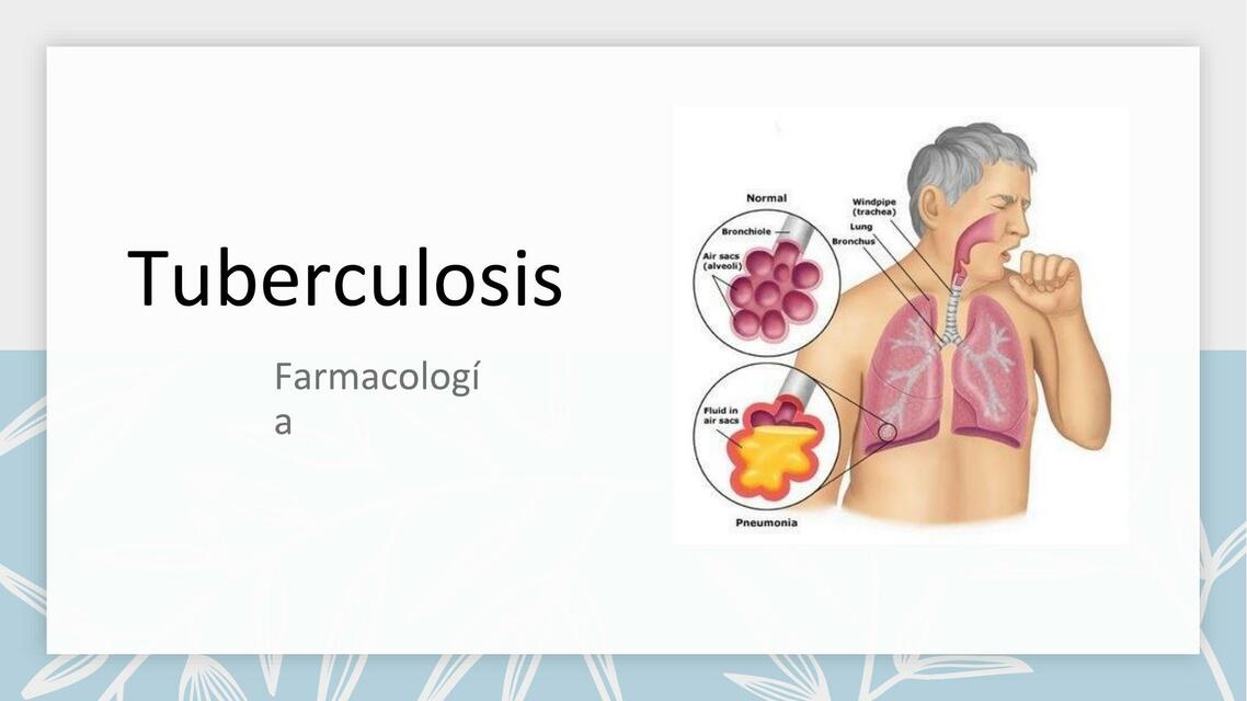 Tuberculosis